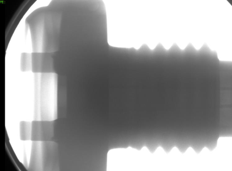 离线X-RAY检查的温度传感器 离线X-RAY检查的温度传感器