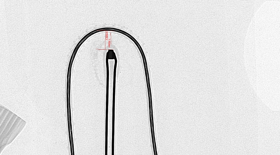 Xray检测传感器的实用案例